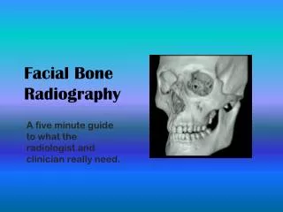 Facial Bone Radiography