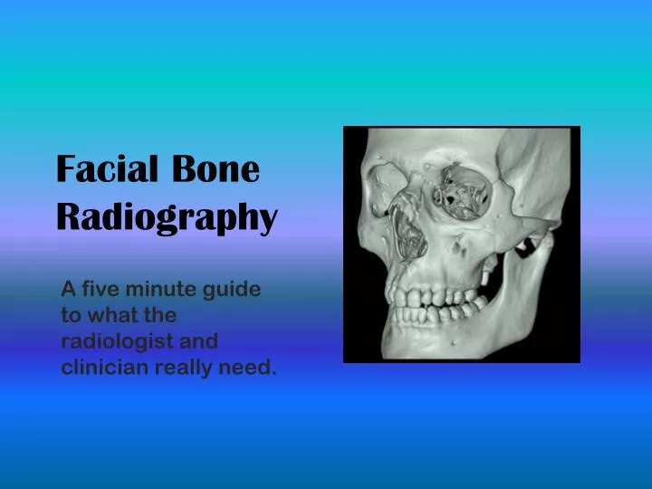 facial bone radiography