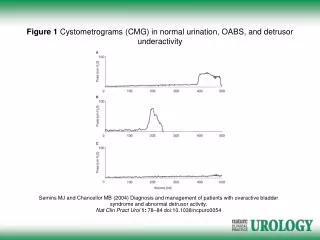 Figure 1 Cystometrograms (CMG) in normal urination, OABS, and detrusor underactivity