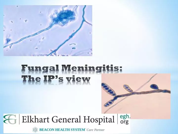 fungal meningitis the ip s view