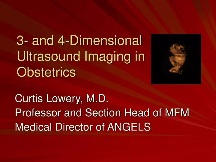 3 and 4 dimensional ultrasound imaging in obstetrics