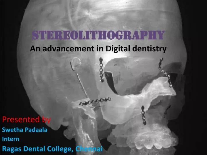 stereolithography an advancement in digital dentistry