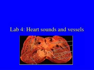 Lab 4: Heart sounds and vessels