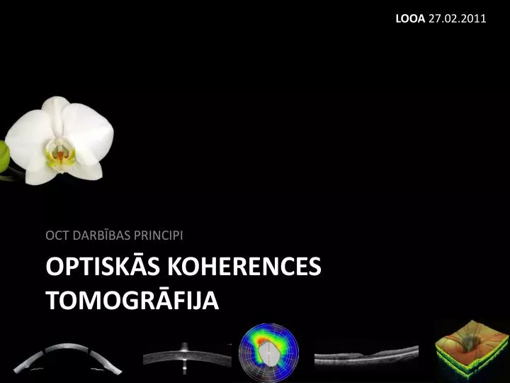 optisk s koherences tomogr fija