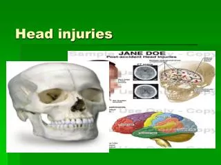 Head injuries