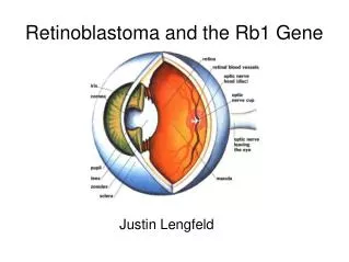 Retinoblastoma and the Rb1 Gene