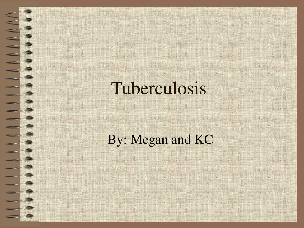PPT - Tuberculosis PowerPoint Presentation, free download - ID:2410319