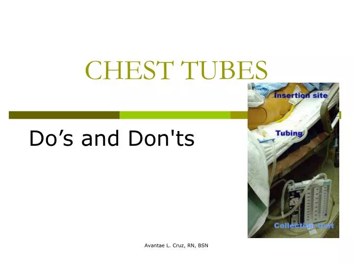 chest tubes