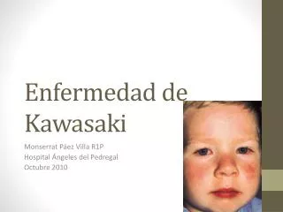 enfermedad de kawasaki