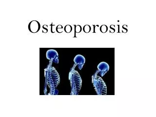 Osteoporosis