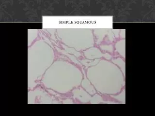 simple squamous