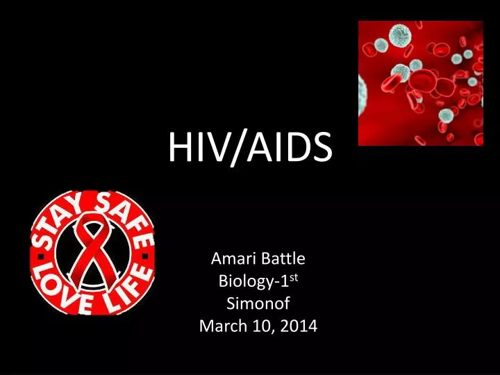 hiv aids