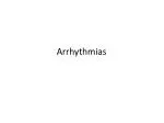 Arrhythmias - slide 1