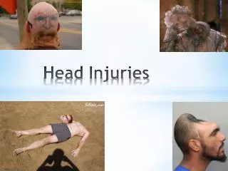 Head Injuries