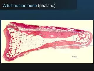 Adult human bone (phalanx)