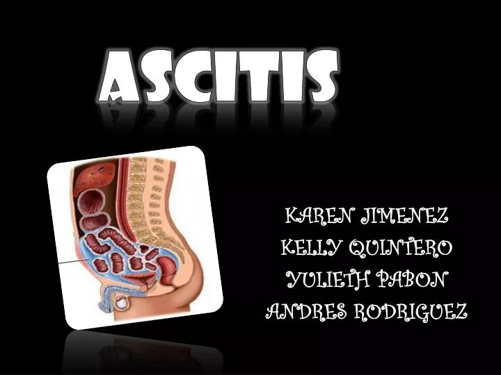 ascitis