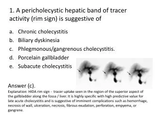 1. A pericholecystic hepatic band of tracer activity (rim sign) is suggestive of