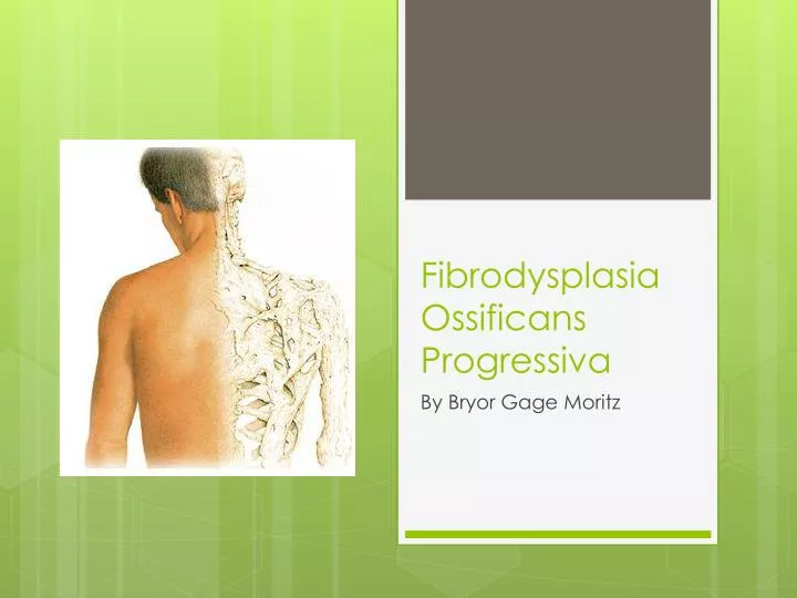 fibrodysplasia ossificans progressiva