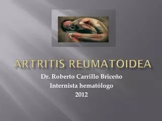 artritis reumatoidea