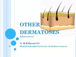 o ther dermatoses R:Rosenstock