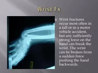 Wrist Fx