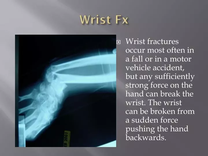 wrist fx