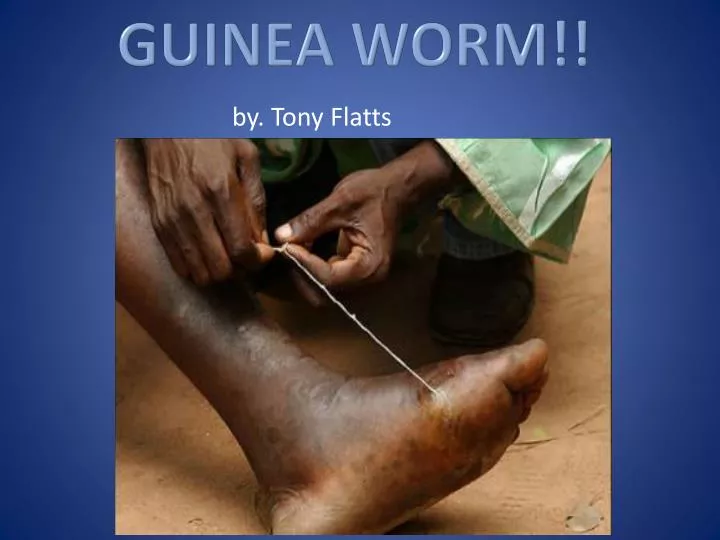 guinea worm