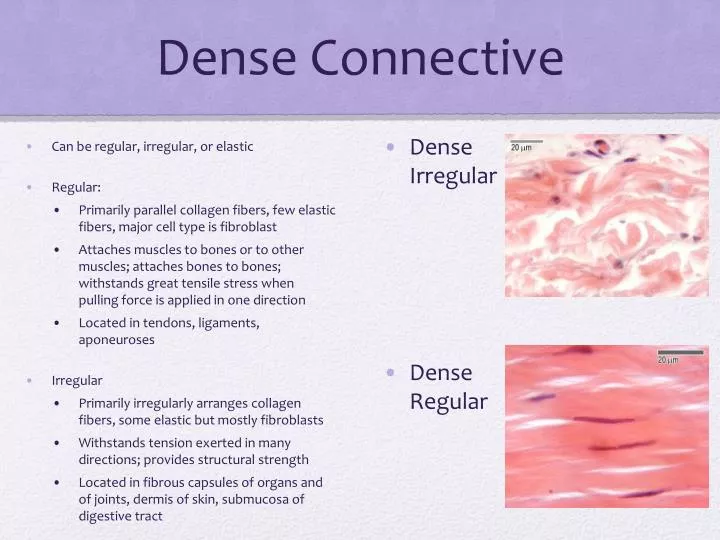 dense connective