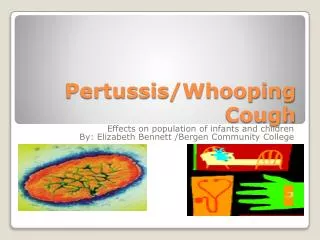 Pertussis /Whooping Cough