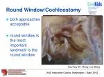 Round Window/Cochleostomy