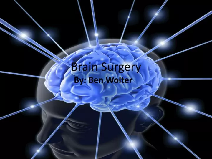 brain surgery