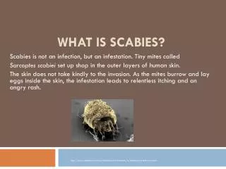 What Is Scabies?