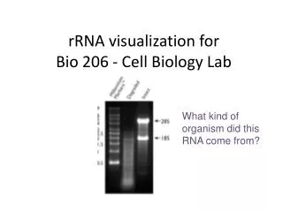rRNA visualization for Bio 206 - Cell Biology Lab