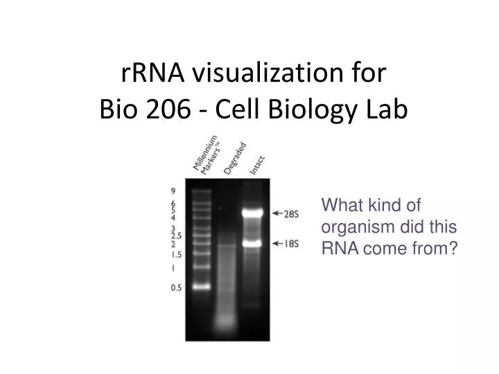 rrna visualization for bio 206 cell biology lab