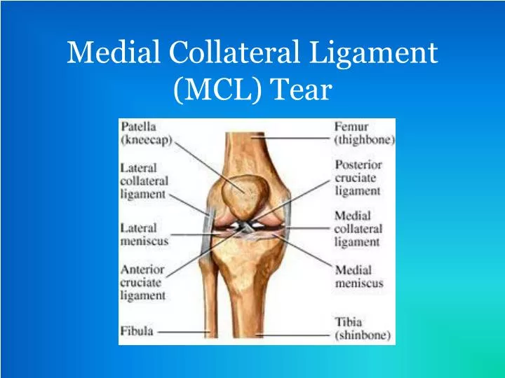 medial collateral ligament mcl tear