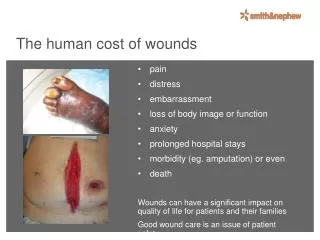 The human cost of wounds