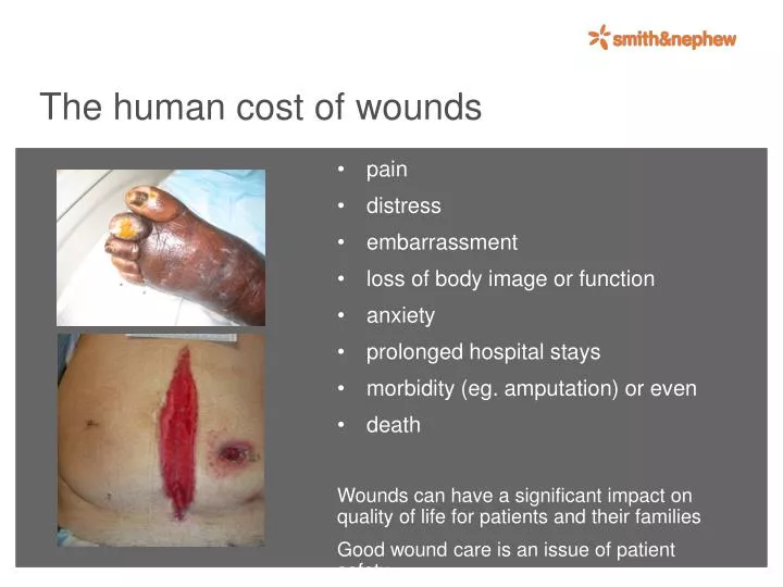 the human cost of wounds