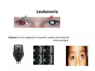 Leukocoria