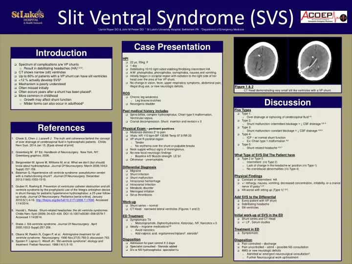 slit ventral syndrome svs