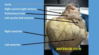 Aorta Right auricle (right atrium) Pulmonary trunk Left auricle (left atrium) Right ventricle