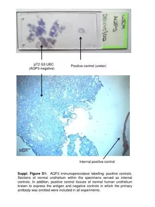 Positive control ( ureter )