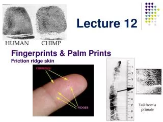 Fingerprints &amp; Palm Prints Friction ridge skin