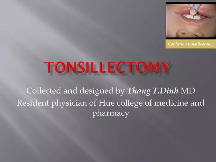 Ppt Tonsillectomy Powerpoint Presentation Free Download Id2488414