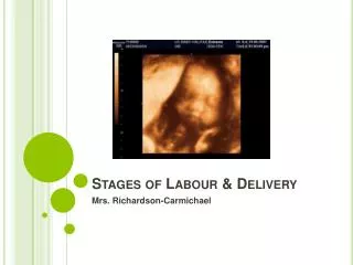 Stages of Labour &amp; Delivery