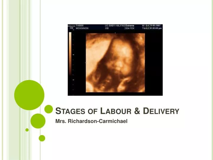 stages of labour delivery