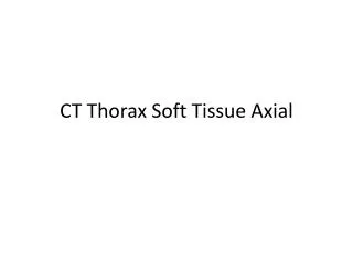 ct thorax soft tissue axial