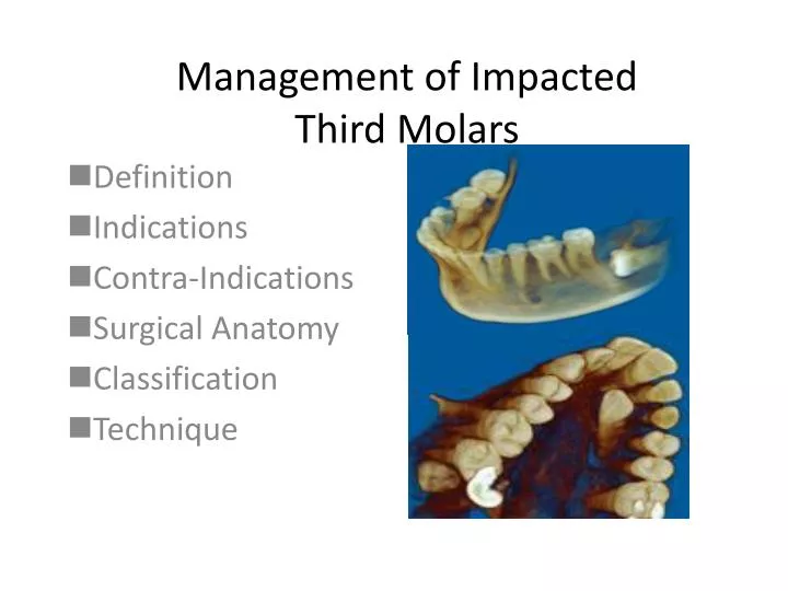 management of impacted third molars
