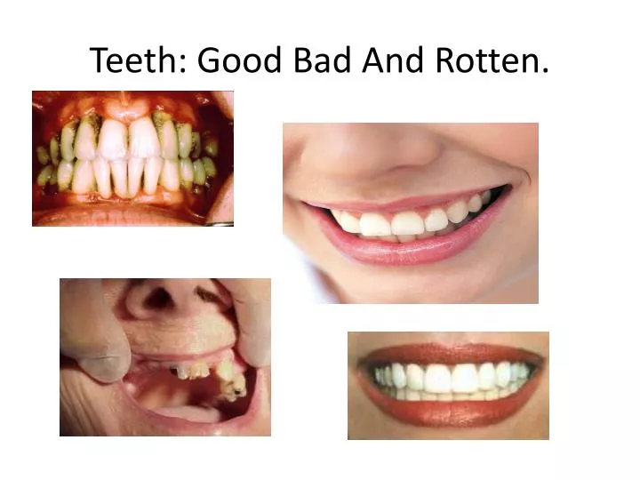 teeth good bad and rotten