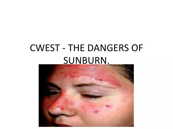 cwest the dangers of sunburn