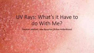 UV Rays: What’s it Have to do With Me?